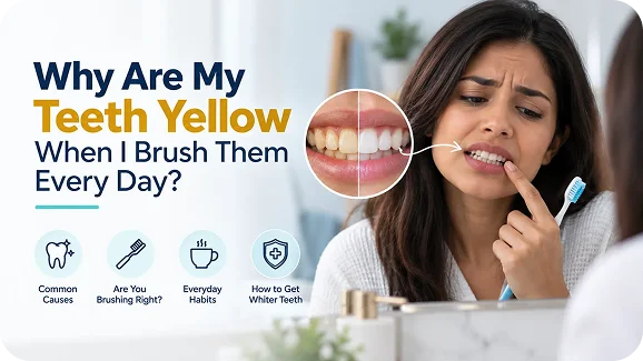 Why Are My Teeth Yellow When I Brush Them Every Day?